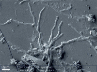 Neurona vitrificada por vesubio